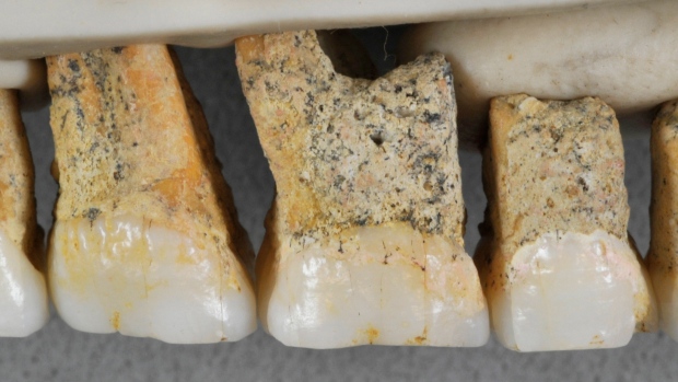 Alcuni dei denti della nuova specie di Homo. Credit: Callao Cave Archaeology Project