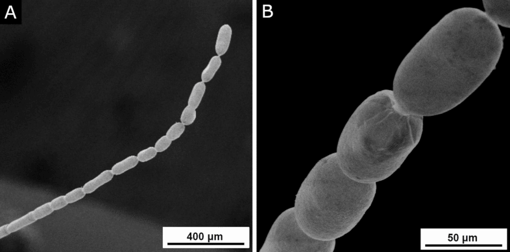 Batterio Piu Grande Del Mondo Thiomargarita Magnifica Microscopio Elettronico